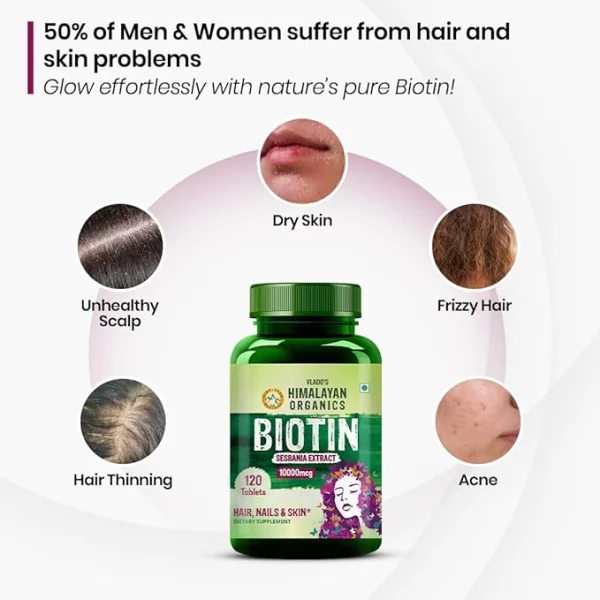 Vlado's Himalayan Organics Biotin 10,000mcg bottle surrounded by common hair and skin issues: dry skin, frizzy hair, acne, hair thinning, unhealthy scalp.